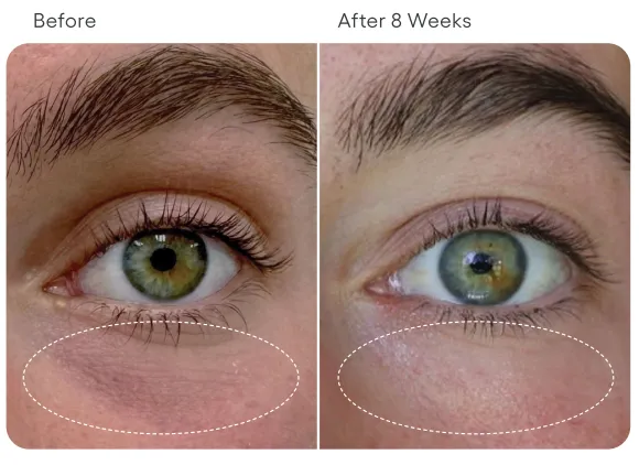 Eye Serum