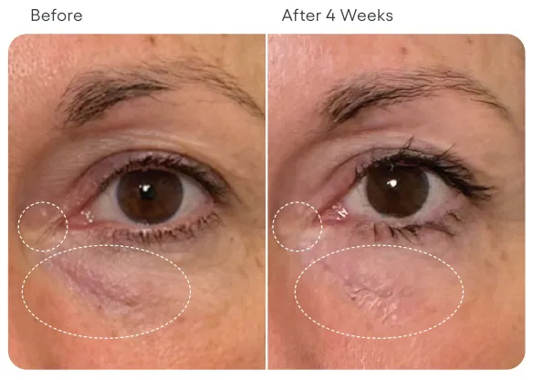 Eye Serum