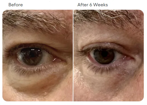 Eye Serum