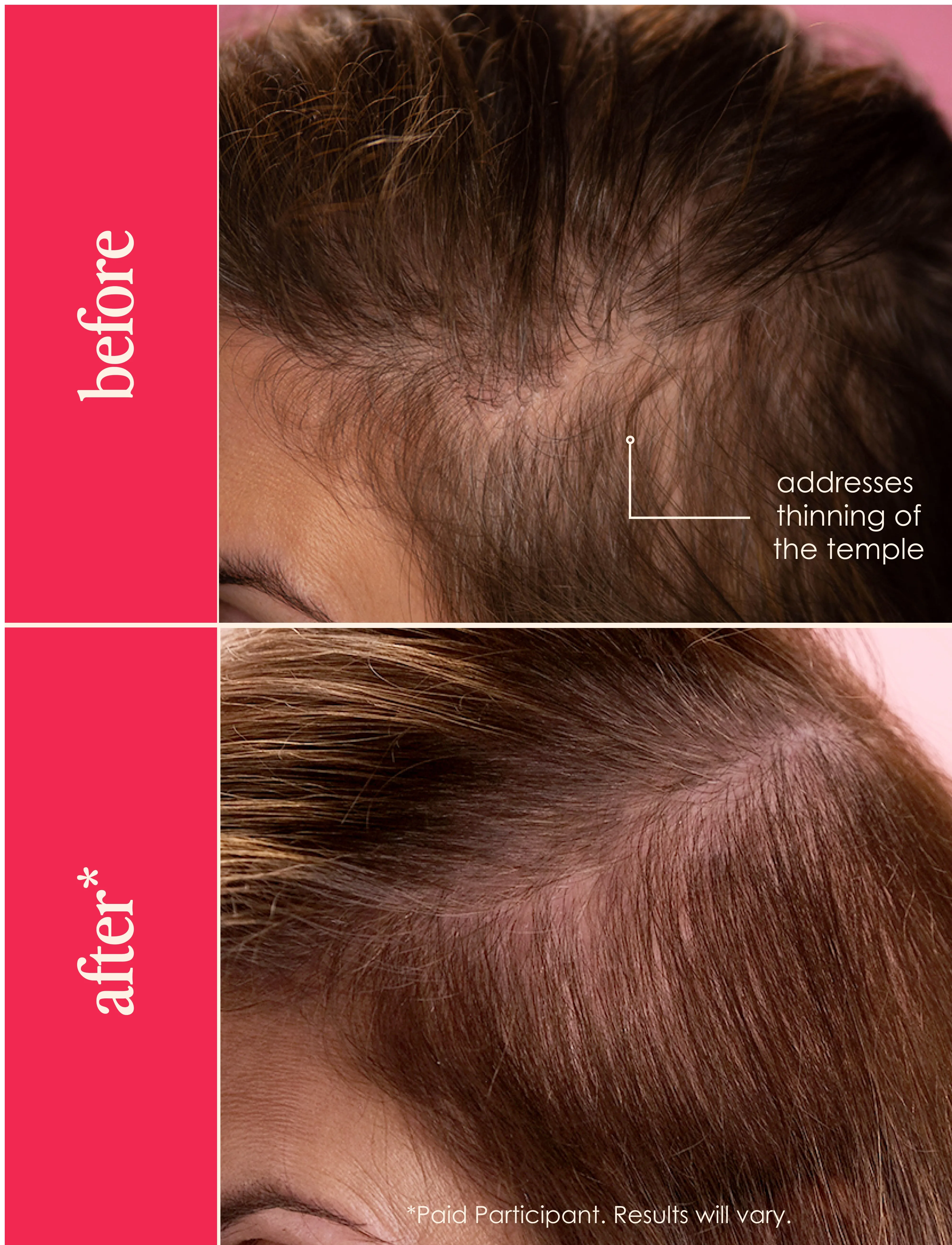 GrandeHAIR Full Boost Starter Kit