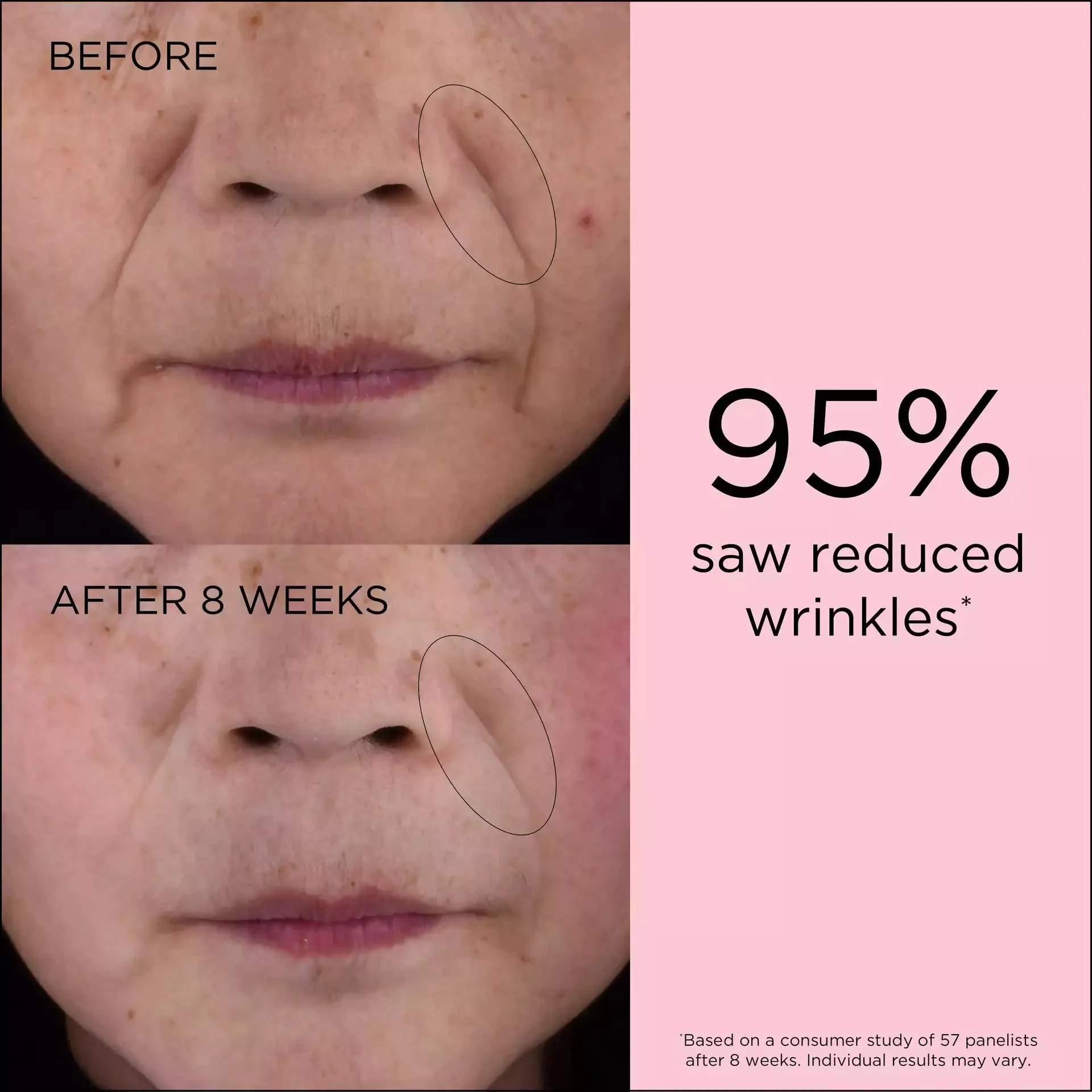 Retinol   HPR Ceramide Capsules Rapid Skin Renewing Serum